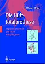 Die Hüfttotalprothese