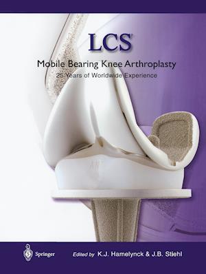 LCS® Mobile Bearing Knee Arthroplasty