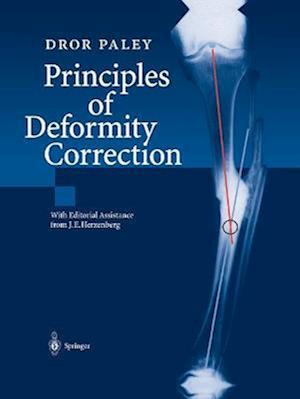 Principles of Deformity Correction