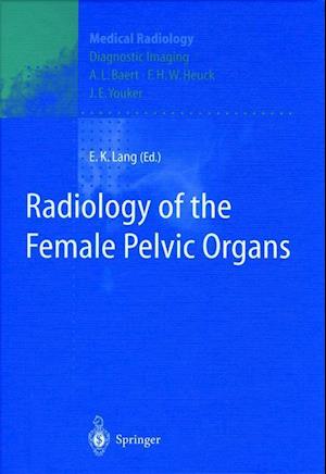 Radiology of the Female Pelvic Organs