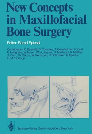 New Concepts in Maxillofacial Bone Surgery