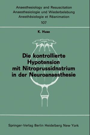 Die kontrollierte Hypotension mit Nitroprussidnatrium in der Neuroanaesthesie
