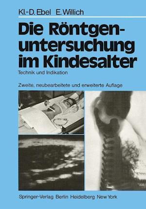 Die Rontgenuntersuchung im Kindesalter