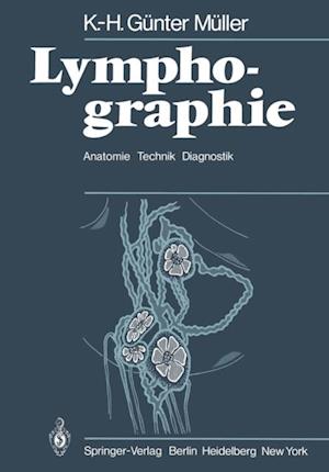 Lymphographie