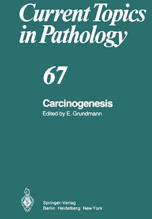 Carcinogenesis