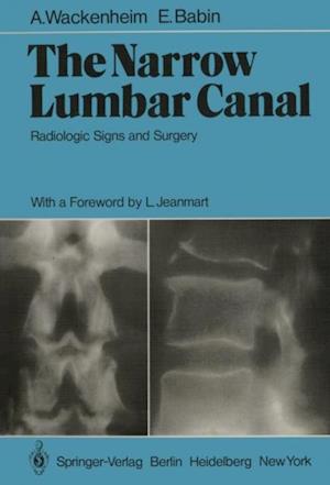 Narrow Lumbar Canal