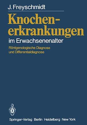 Knochenerkrankungen im Erwachsenenalter