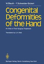 Congenital Deformities of the Hand