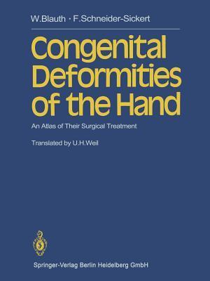 Congenital Deformities of the Hand