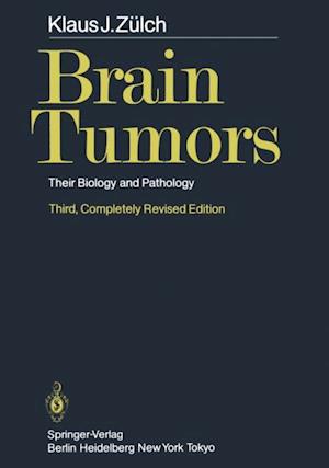 Brain Tumors