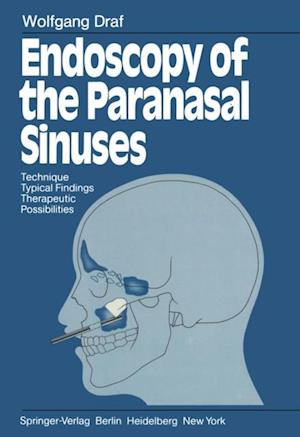 Endoscopy of the Paranasal Sinuses