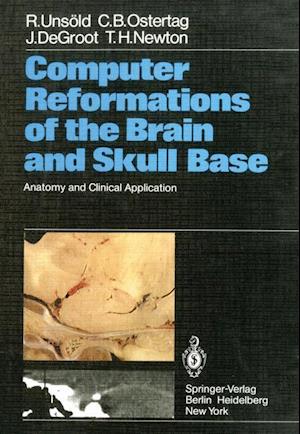 Computer Reformations of the Brain and Skull Base