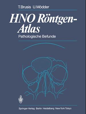 HNO Röntgen-Atlas