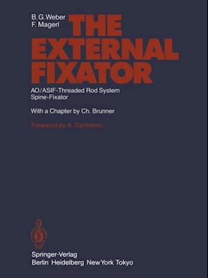 External Fixator