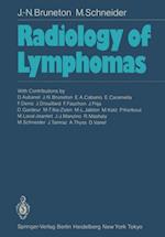 Radiology of Lymphomas