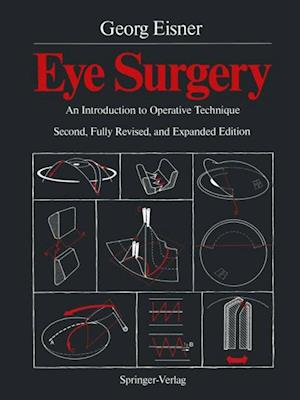 Eye Surgery