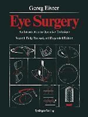 Eye Surgery