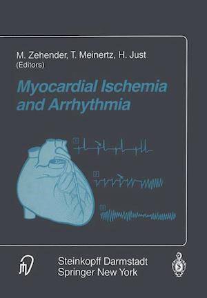Myocardial Ischemia and Arrhythmia