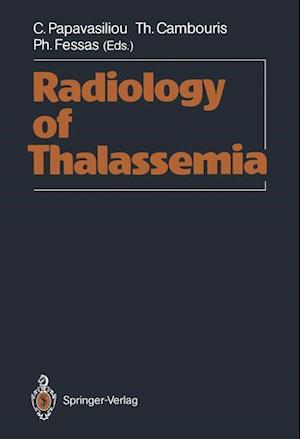 Radiology of Thalassemia