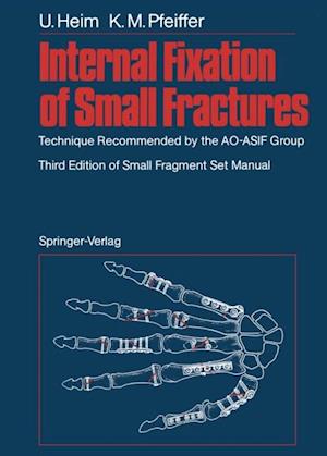 Internal Fixation of Small Fractures