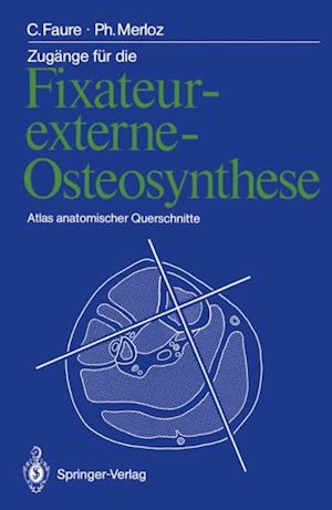 Zugänge für die Fixateur-externe-Osteosynthese