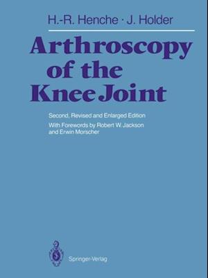 Arthroscopy of the Knee Joint