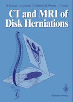 CT and MRI of Disk Herniations