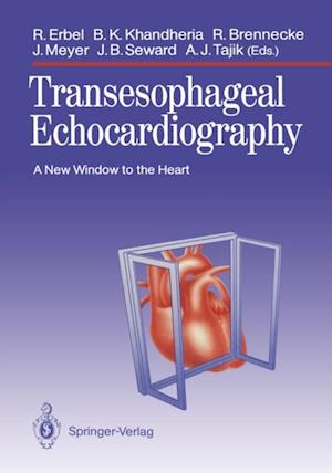 Transesophageal Echocardiography