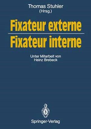 Fixateur externe — Fixateur interne