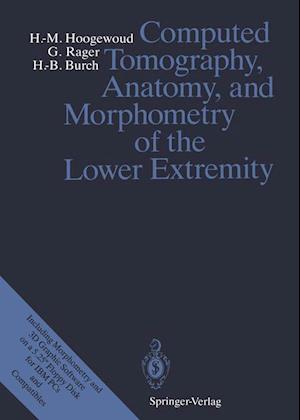 Computed Tomography, Anatomy, and Morphometry of the Lower Extremity