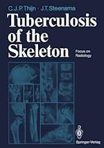 Tuberculosis of the Skeleton