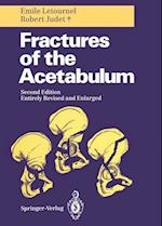 Fractures of the Acetabulum