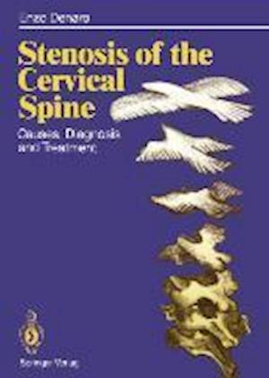 Stenosis of the Cervical Spine