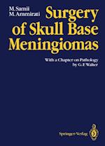 Surgery of Skull Base Meningiomas