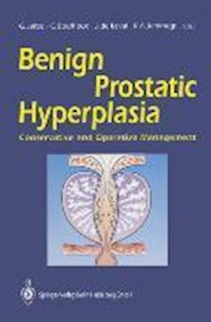 Benign Prostatic Hyperplasia