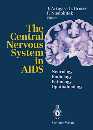 Central Nervous System in AIDS