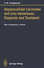 Hepatocellular Carcinoma and Liver Metastases: Diagnosis and Treatment