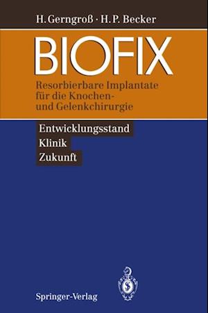 BIOFIX