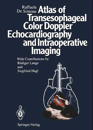 Atlas of Transesophageal Color Doppler Echocardiography and Intraoperative Imaging