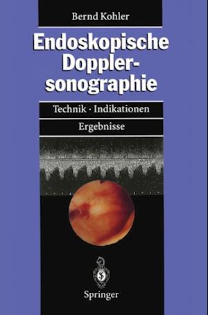 Endoskopische Dopplersonographie