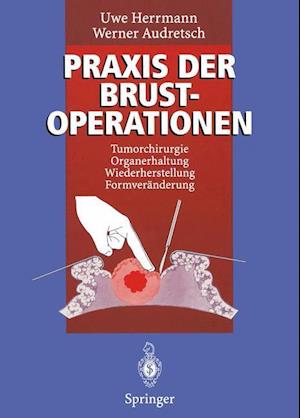 Praxis der Brustoperationen