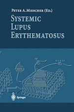 Systemic Lupus Erythematosus