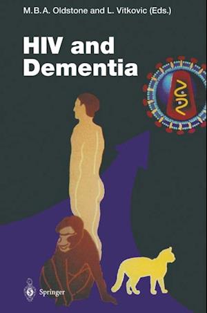 HIV and Dementia