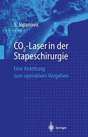 Co2-Laser in Der Stapeschirurgie