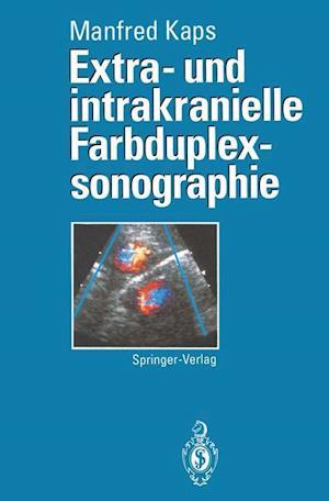 Extra- und intrakranielle Farbduplexsonographie