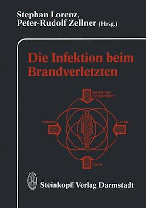 Die Infektion beim Brandverletzten