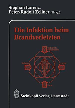 Die Infektion Beim Brandverletzten