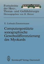 Computergestützte sonographische Gewebedifferenzierung des Myokards