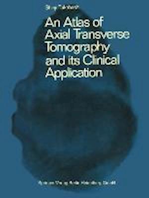 An Atlas of Axial Transverse Tomography and its Clinical Application