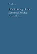 Biomicroscopy of the Peripheral Fundus